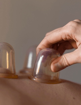Cupping